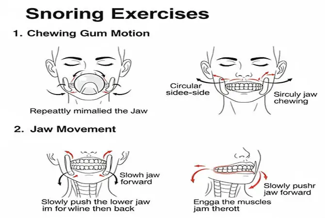 চোয়ালের ব্যায়াম