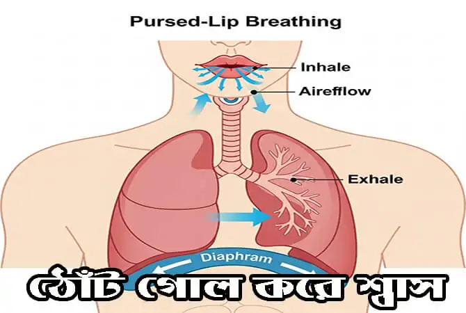 পার্সড-লিপ ব্রিদিং বা ঠোঁট গোল করে শ্বাস