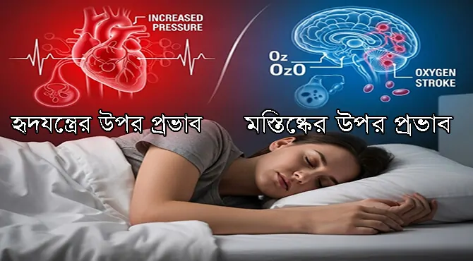 স্বাভাবিক ঘুমের মধ্যে নিঃশ্বাস বন্ধ হওয়ার জটিলতা